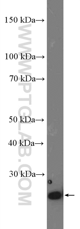 Western Blot (WB) analysis of MCF-7 cells using TCEAL1 Polyclonal antibody (11993-1-AP)