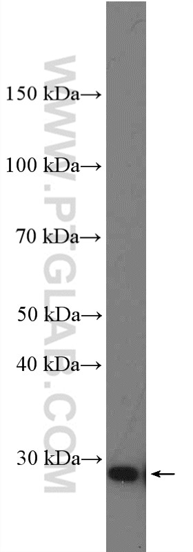 Western Blot (WB) analysis of HeLa cells using TCEAL1 Polyclonal antibody (11993-1-AP)