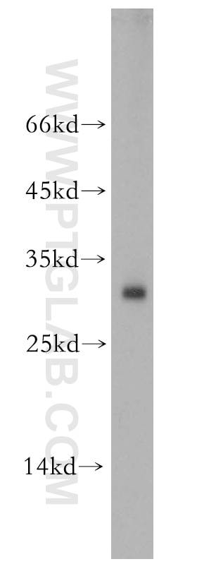 TCEAL1