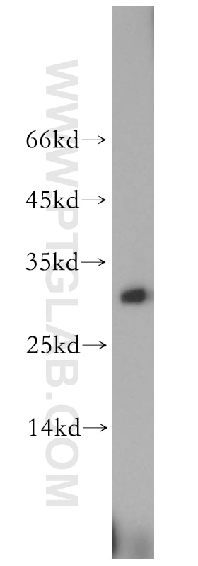 Western Blot (WB) analysis of MCF-7 cells using TCEAL1 Polyclonal antibody (11993-1-AP)