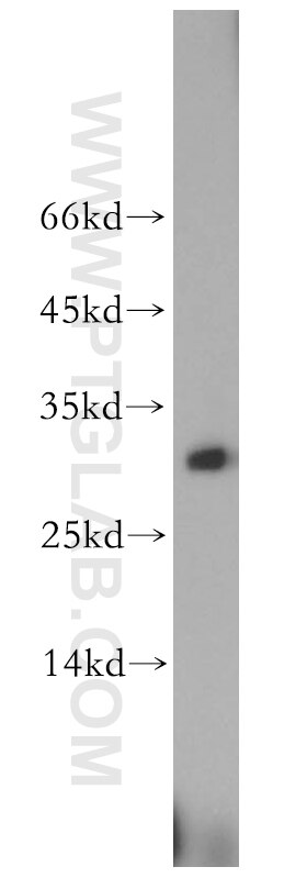 WB analysis of MCF-7 using 11993-1-AP