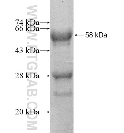 TCEAL6 fusion protein Ag11827 SDS-PAGE