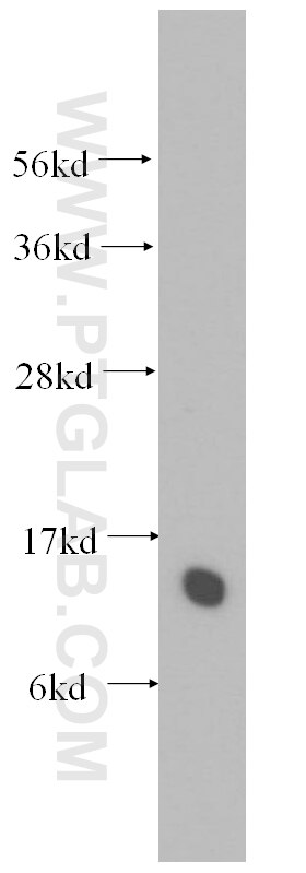 Western Blot (WB) analysis of human liver tissue using TCEAL7 Polyclonal antibody (11218-1-AP)