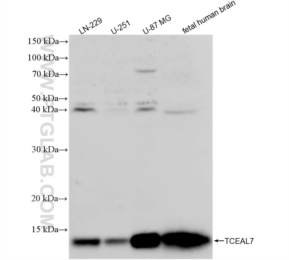 WB analysis using 87945-1-RR (same clone as 87945-1-PBS) Western Blot (WB) analysis of various lysates using TCEAL7 Recombinant monoclonal antibody (87945-1-RR)
