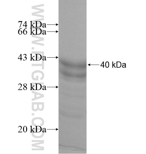 TCEAL8 fusion protein Ag11081 SDS-PAGE