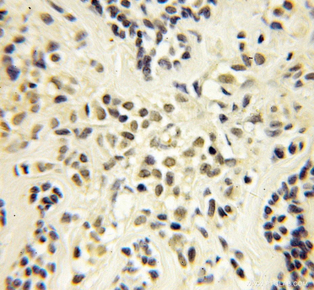 TCEB1 Polyclonal antibody