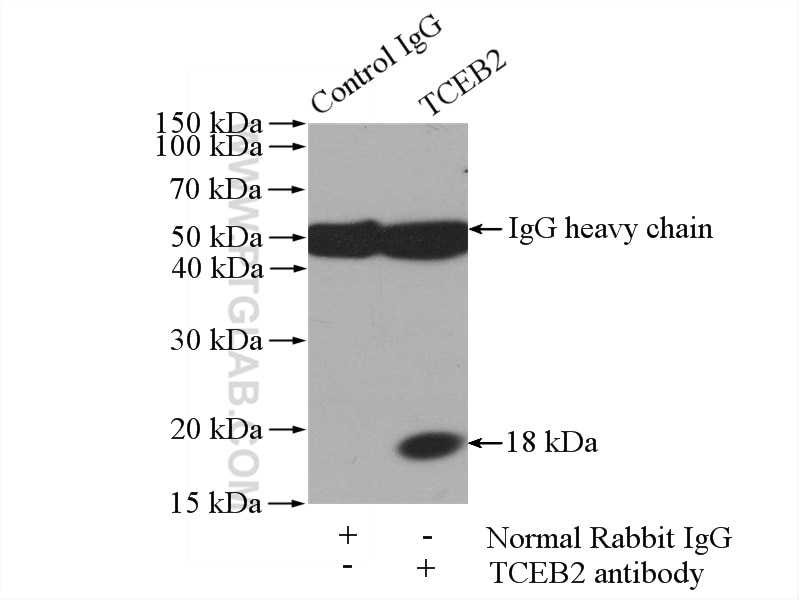 Immunoprecipitation (IP) experiment of HEK-293 cells using TCEB2/Elongin-B Polyclonal antibody (10779-1-AP)