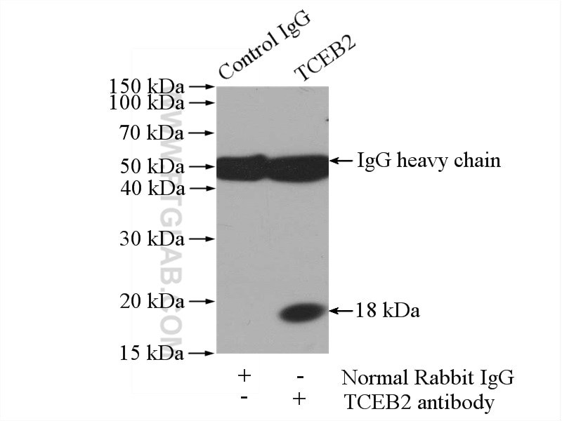 IP experiment of HEK-293 using 10779-1-AP