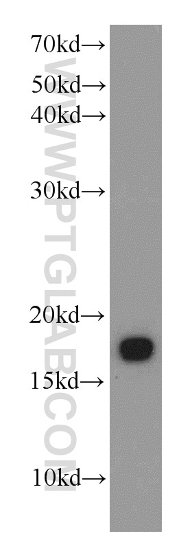 TCEB2/Elongin-B