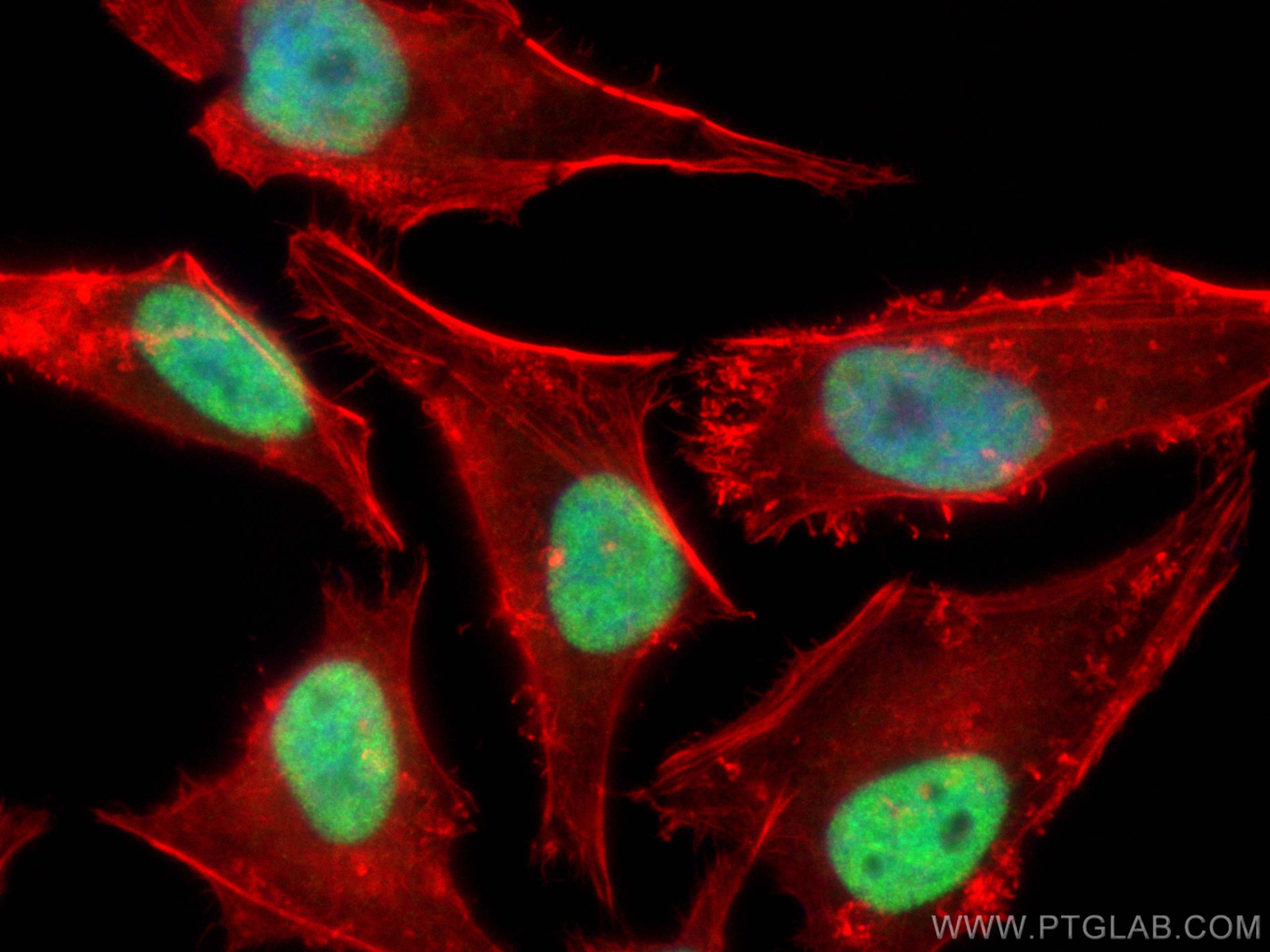 Immunofluorescence (IF) / fluorescent staining of HeLa cells using TCEB3 Polyclonal antibody (10502-1-AP)