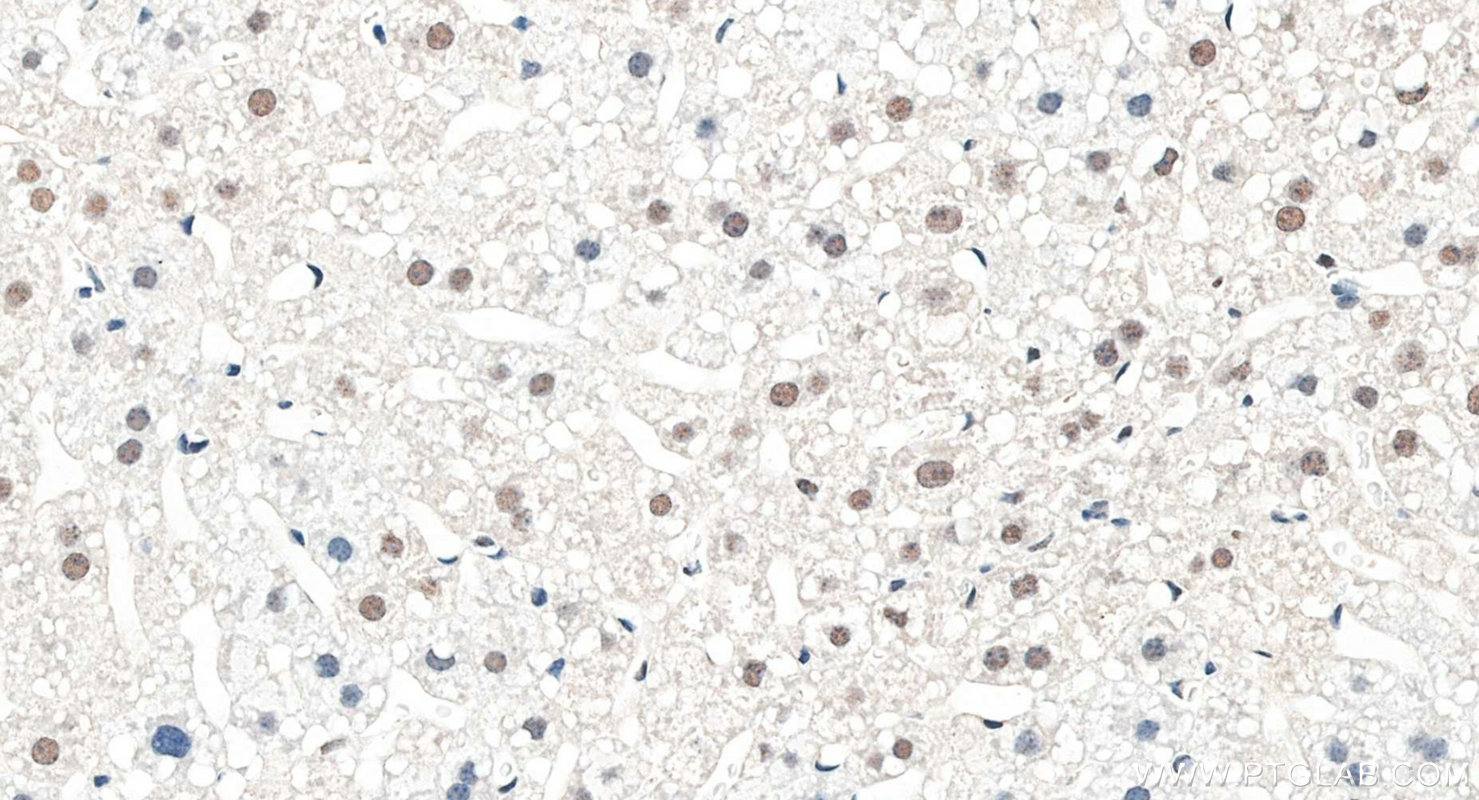 Immunohistochemistry (IHC) staining of mouse liver tissue using TCEB3 Polyclonal antibody (10502-1-AP)