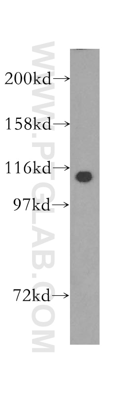 Western Blot (WB) analysis of mouse brain tissue using TCEB3 Polyclonal antibody (10502-1-AP)