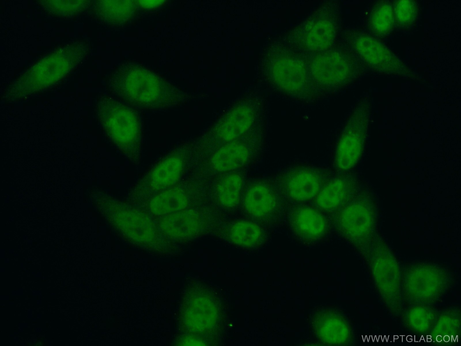 Immunofluorescence (IF) / fluorescent staining of HeLa cells using TCERG1 Polyclonal antibody (21858-1-AP)