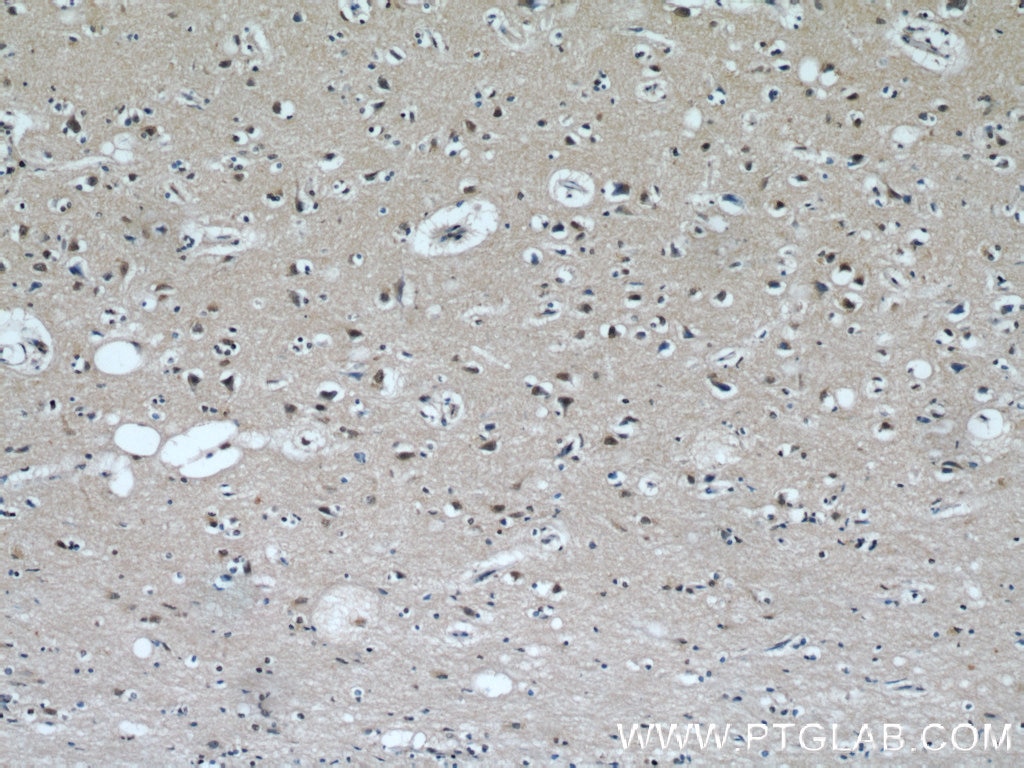 IHC staining of human brain using 21858-1-AP