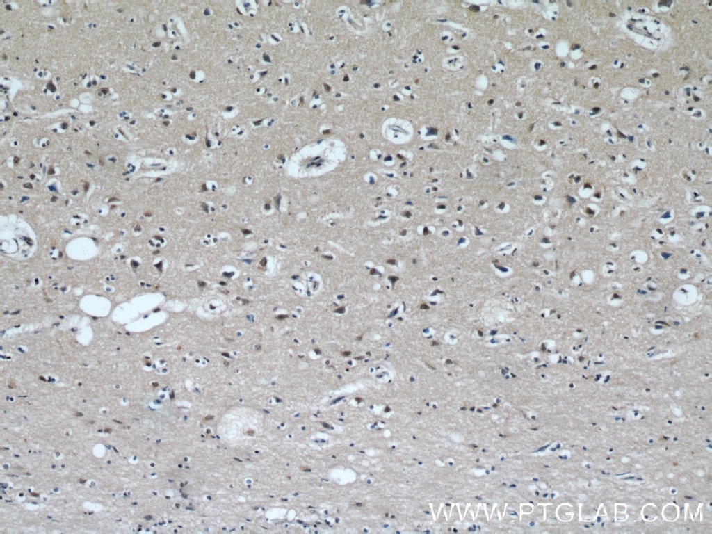 Immunohistochemistry (IHC) staining of human brain tissue using TCERG1 Polyclonal antibody (21858-1-AP)