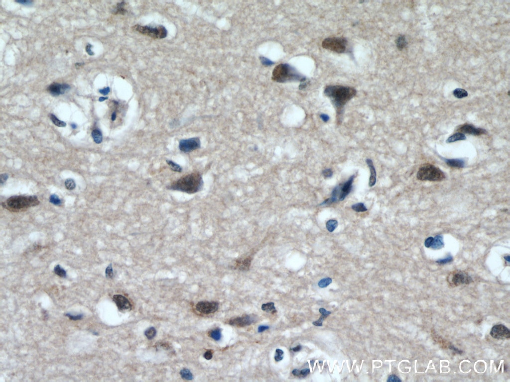 Immunohistochemistry (IHC) staining of human brain tissue using TCERG1 Polyclonal antibody (21858-1-AP)