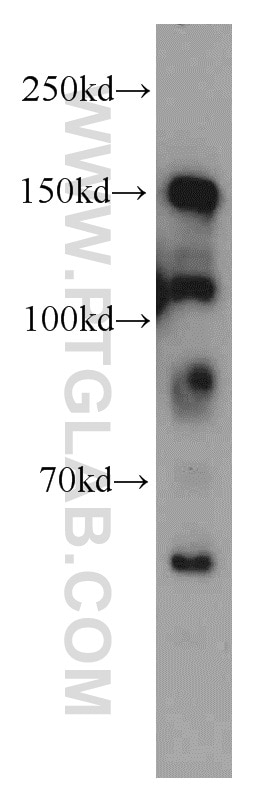 Western Blot (WB) analysis of HeLa cells using TCERG1 Polyclonal antibody (21858-1-AP)