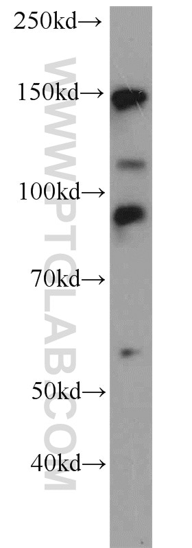 Western Blot (WB) analysis of NIH/3T3 cells using TCERG1 Polyclonal antibody (21858-1-AP)
