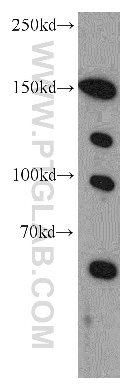 Western Blot (WB) analysis of HEK-293 cells using TCERG1 Polyclonal antibody (21858-1-AP)
