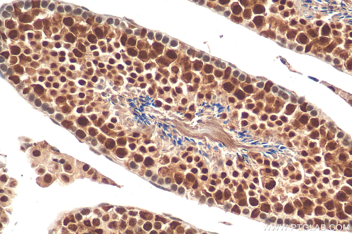 Immunohistochemistry (IHC) staining of mouse testis tissue using TCERG1L Polyclonal antibody (20858-1-AP)