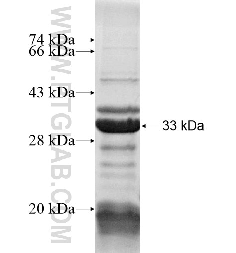 TCERG1L fusion protein Ag14828 SDS-PAGE