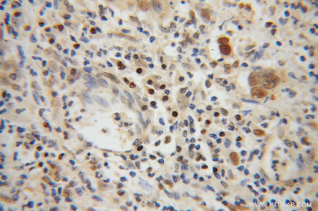 TCF12/HEB Polyclonal antibody