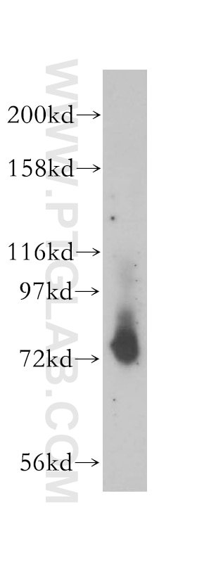 TCF12/HEB Polyclonal antibody