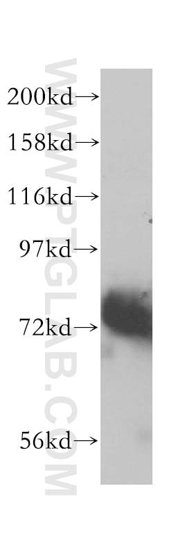 Western Blot (WB) analysis of Raji cells using TCF12/HEB Polyclonal antibody (14419-1-AP)