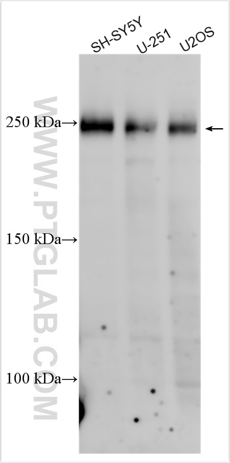 Western Blot (WB) analysis of various lysates using TCF20 Polyclonal antibody (32030-1-AP)