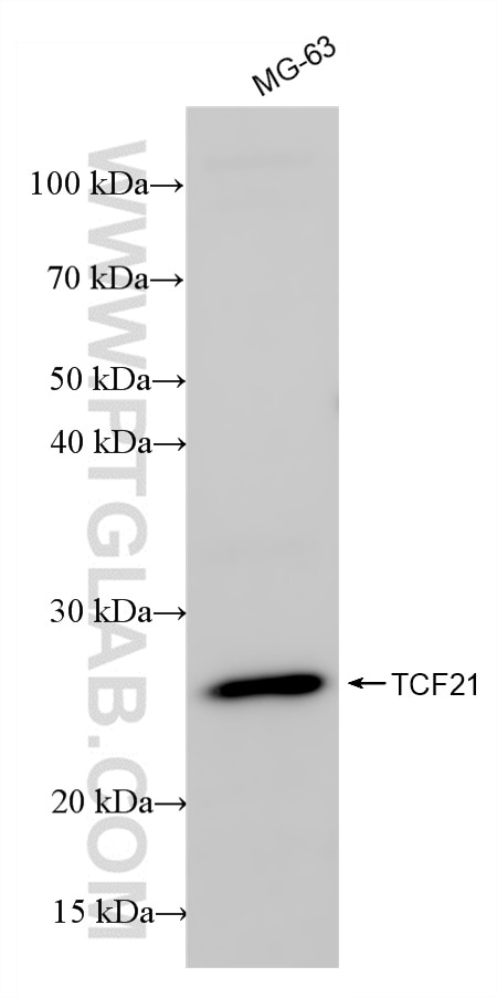 Various lysates were subjected to SDS PAGE followed by western blot with 86294-2-RR (TCF21 antibody) at dilution of 1:10000 incubated at room temperature for 1.5 hours. Western Blot (WB) analysis of various lysates using TCF21 Recombinant antibody (86294-2-RR)