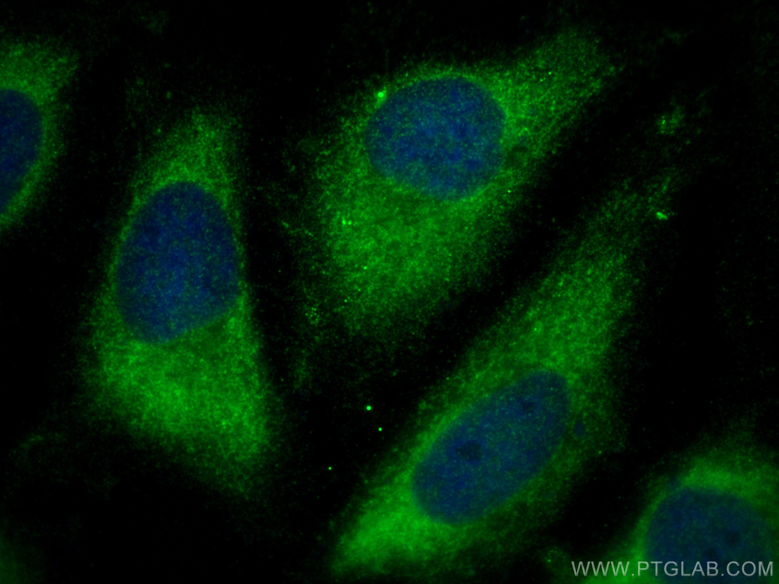 Immunofluorescence (IF) / fluorescent staining of HeLa cells using TCF25 Polyclonal antibody (30852-1-AP)
