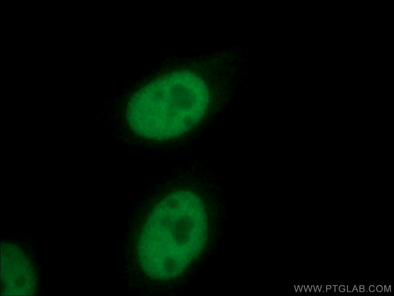 Immunofluorescence (IF) / fluorescent staining of HepG2 cells using E2A Polyclonal antibody (21242-1-AP)
