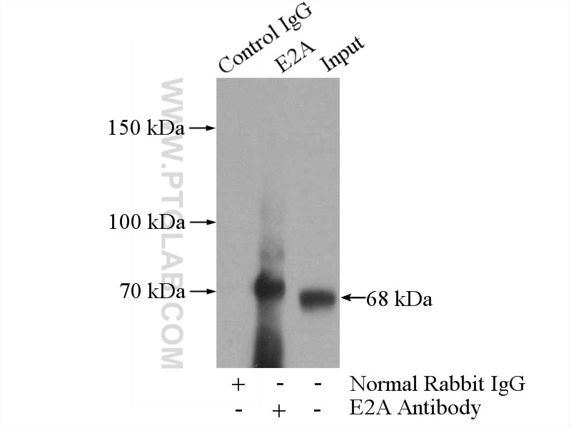 Immunoprecipitation (IP) experiment of Jurkat cells using E2A Polyclonal antibody (21242-1-AP)