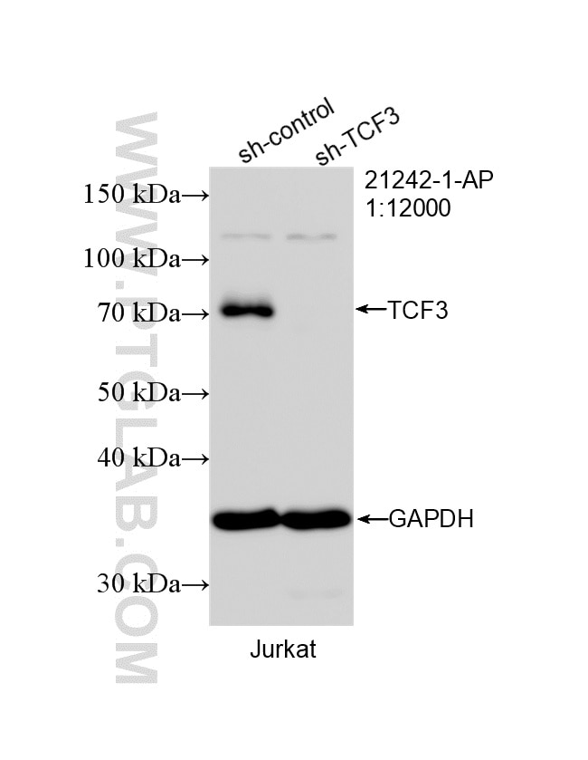 WB analysis of Jurkat using 21242-1-AP Western Blot (WB) analysis of Jurkat cells using TCF3 Polyclonal antibody (21242-1-AP)
