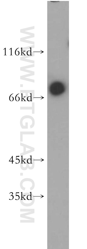 Western Blot (WB) analysis of Jurkat cells using E2A Polyclonal antibody (21242-1-AP)