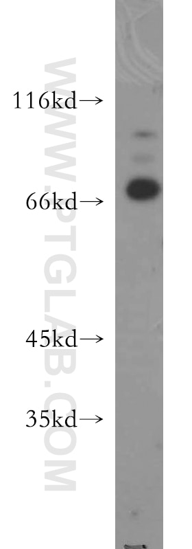 Western Blot (WB) analysis of PC-3 cells using E2A Polyclonal antibody (21242-1-AP)