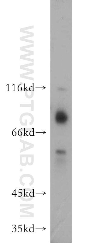 Western Blot (WB) analysis of K-562 cells using E2A Polyclonal antibody (21242-1-AP)
