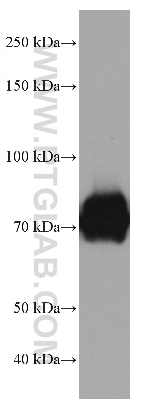 WB analysis of Jurkat using 67140-1-Ig