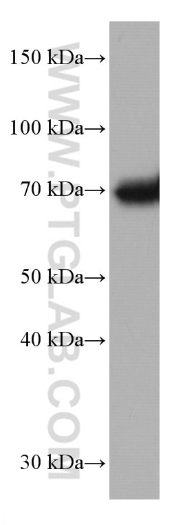 WB analysis of PC-3 using 67140-1-Ig