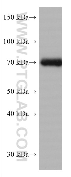 WB analysis of Jurkat using 67140-1-Ig