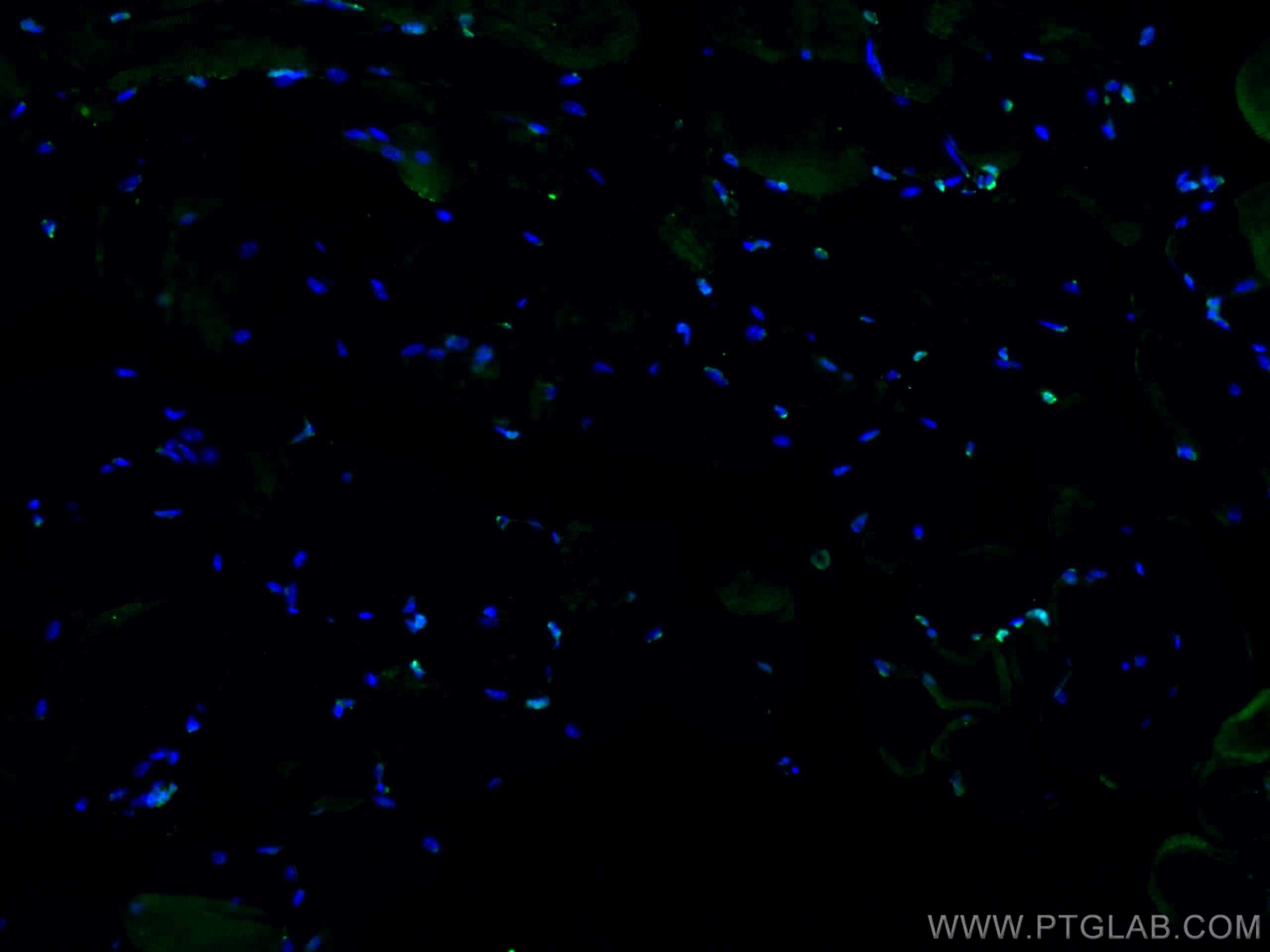 Immunofluorescence (IF) / fluorescent staining of mouse skeletal muscle tissue using TCF4 Polyclonal antibody (22337-1-AP)