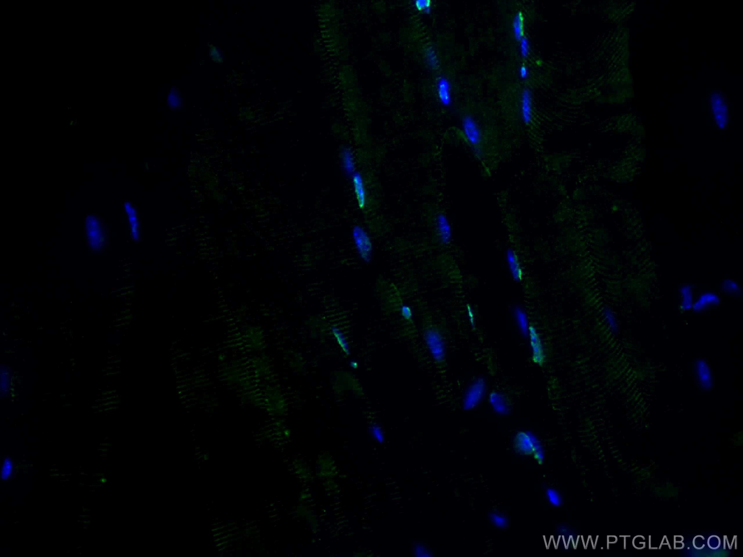 Immunofluorescence (IF) / fluorescent staining of mouse skeletal muscle tissue using TCF4 Polyclonal antibody (22337-1-AP)