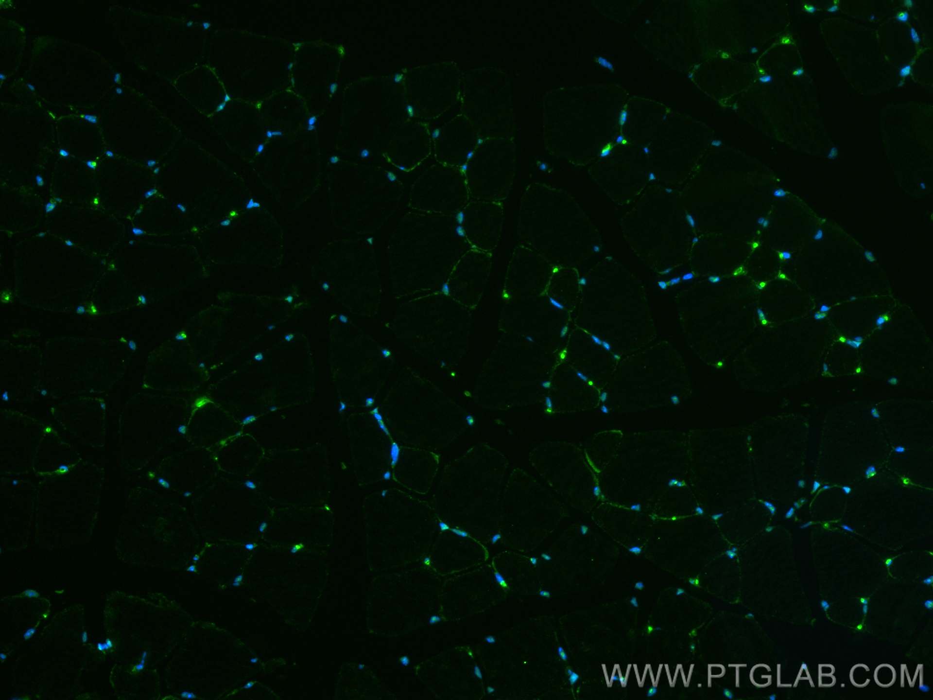 Immunofluorescence (IF) / fluorescent staining of mouse skeletal muscle tissue using TCF4 Polyclonal antibody (22337-1-AP)