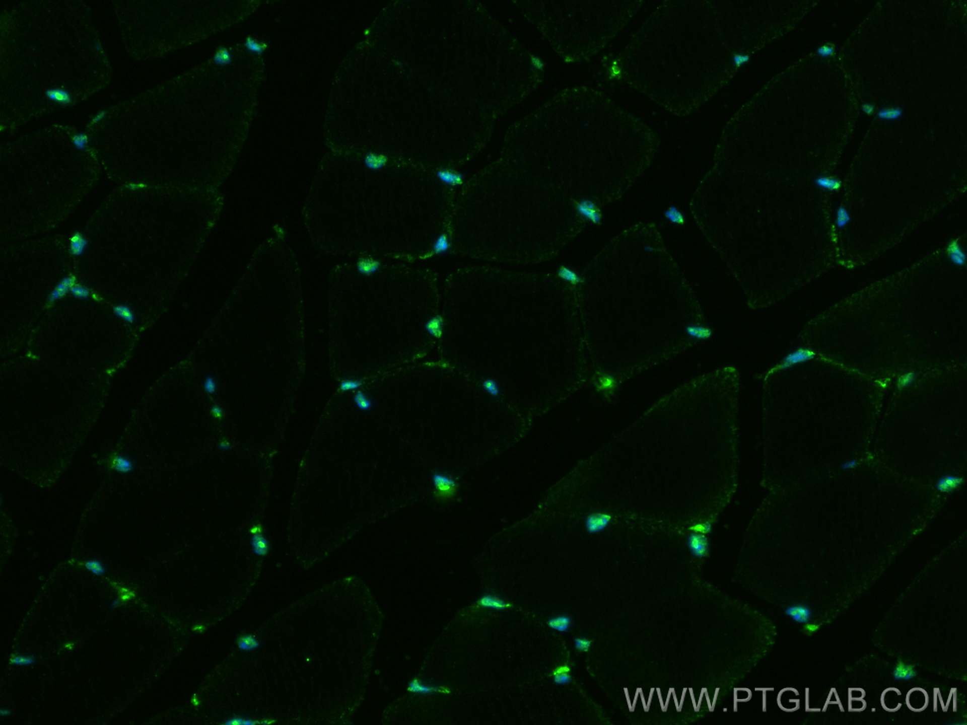 IF Staining of mouse skeletal muscle using 22337-1-AP