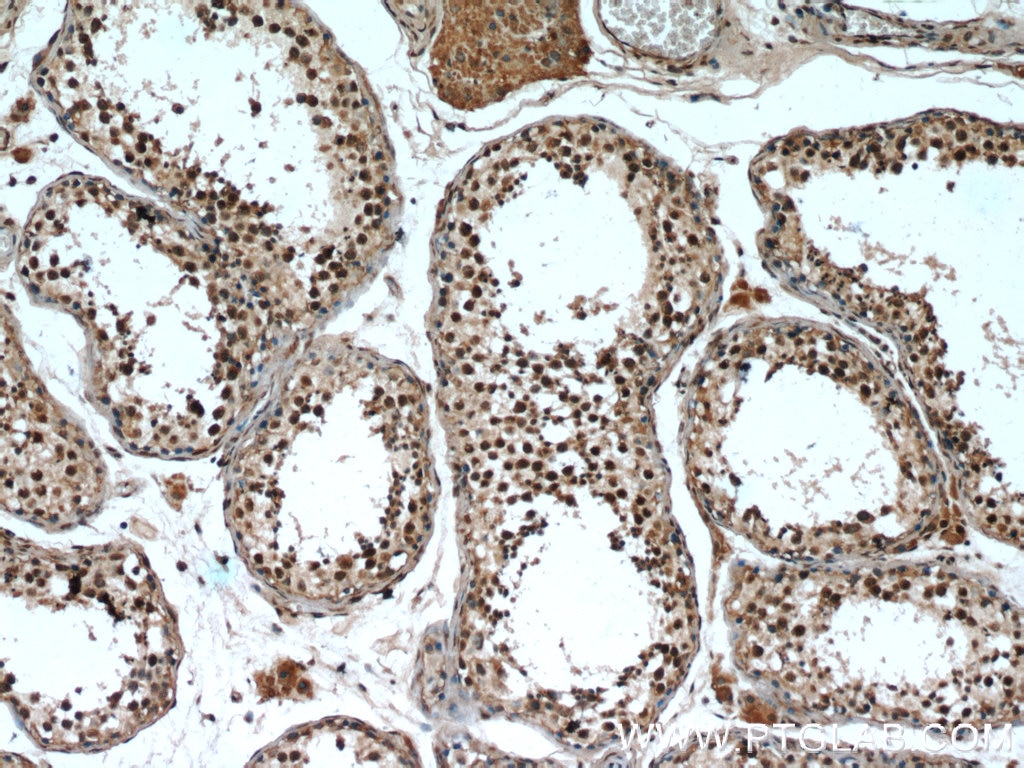 Immunohistochemistry (IHC) staining of human testis tissue using TCF4 Polyclonal antibody (22337-1-AP)