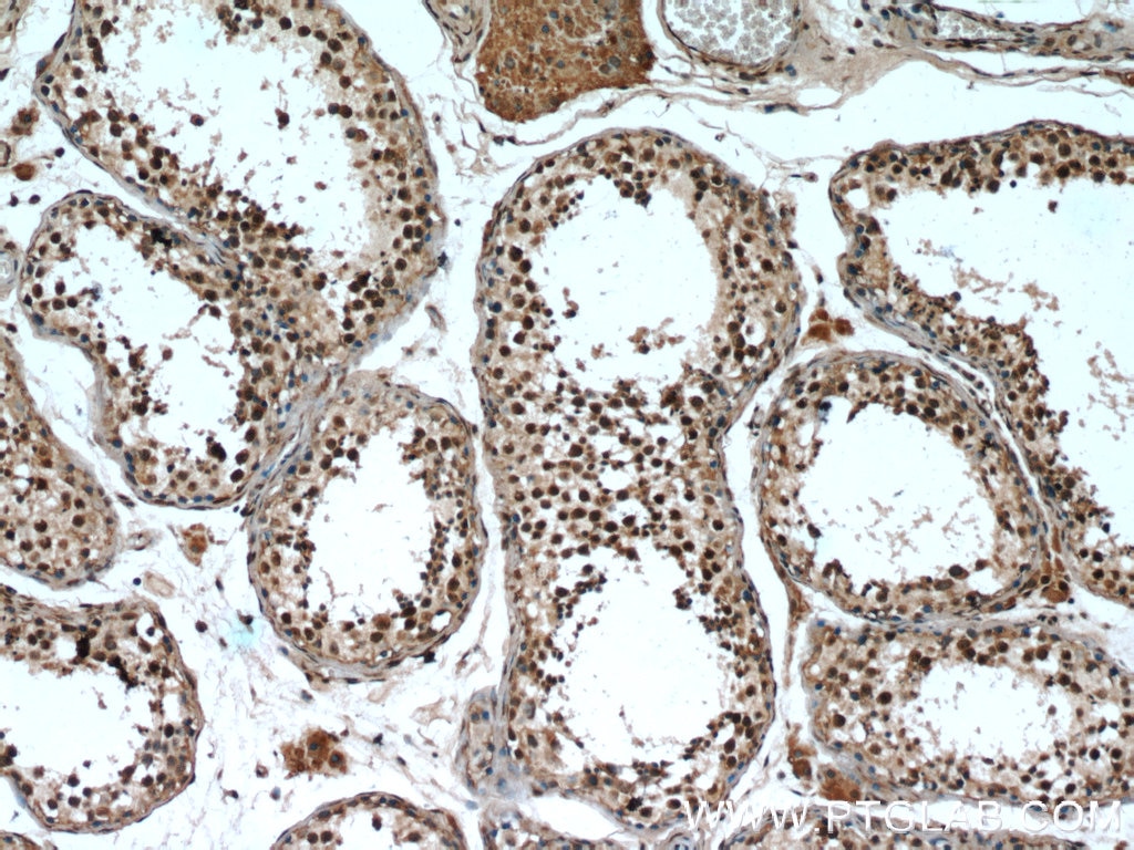 IHC staining of human testis using 22337-1-AP