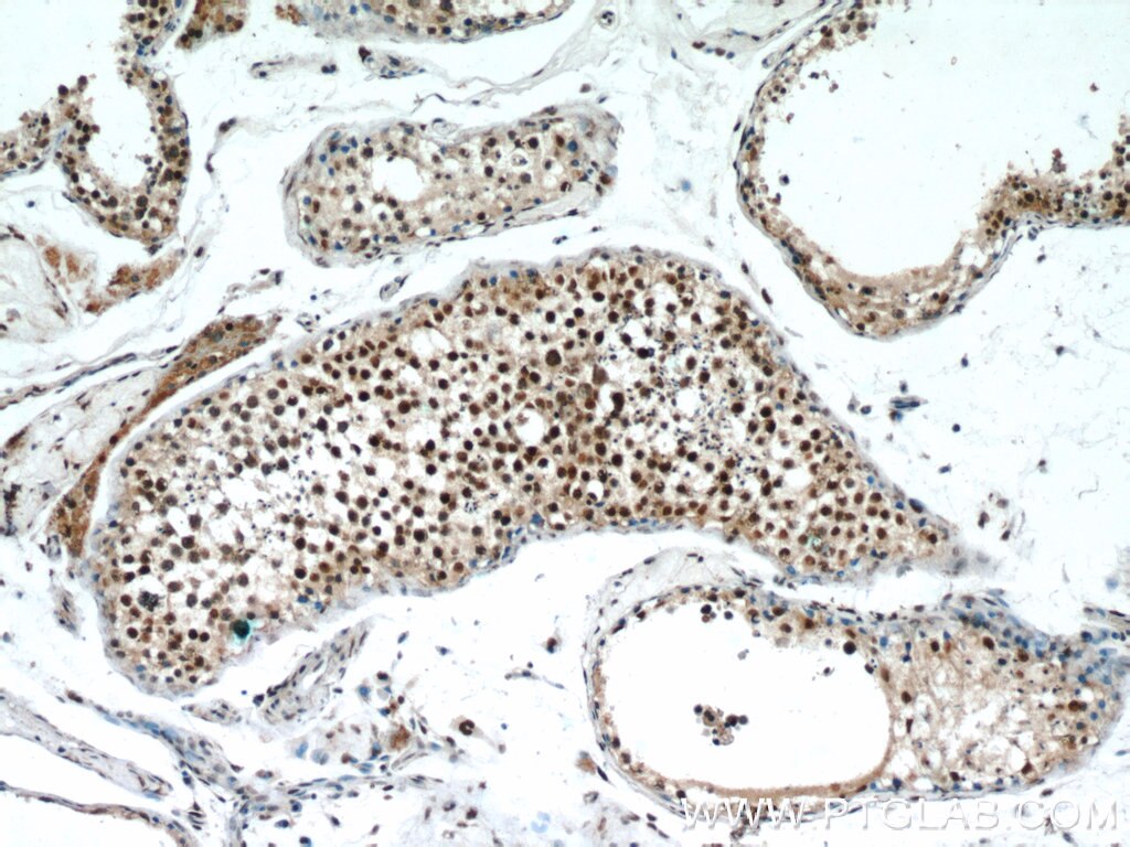 IHC staining of human testis using 22337-1-AP