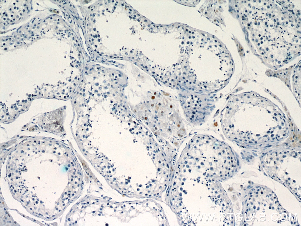 IHC staining of human testis using 22337-1-AP