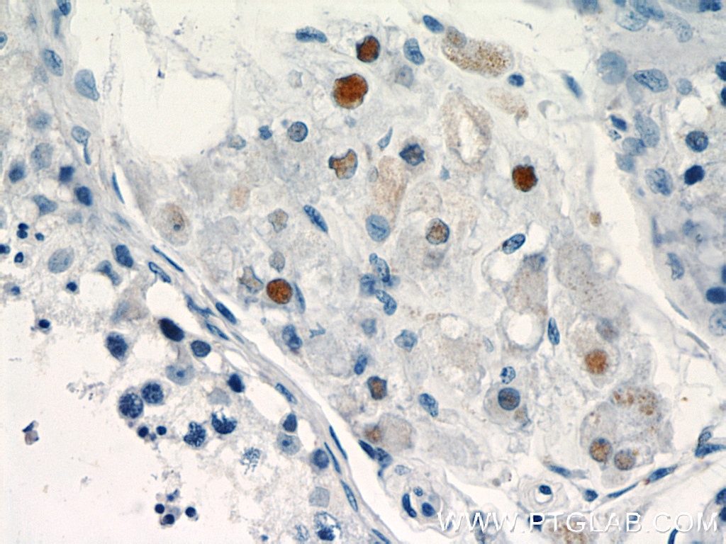 Immunohistochemistry (IHC) staining of human testis tissue using TCF4 Polyclonal antibody (22337-1-AP)