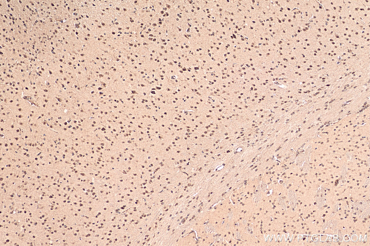 Immunohistochemistry (IHC) staining of mouse brain tissue using TCF4 Polyclonal antibody (22337-1-AP)